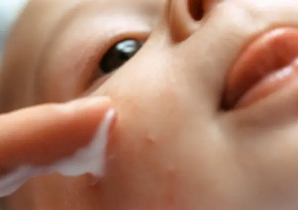 Baby having lotion applied to pipmles on face, extreme close-up
bebe niÒo de pecho puericultura salud crema grano dedo aplicar bebes bebes dedos cremas padres niÒo dos personas caucasico niÒez filiacion enfermedad amor bienestar irritacion hidratacion cuidado vida alergia nueva vida interior dia mano cabeza boca lengua nariz esparcir irritado cara ojo sacar la lengua hidratar amable vista parcial primer plano plano macro foco suave color derramar desparramar salpicar vista acotada cropeo colores infancia niÒos infantes nene manos cabezas bocas lenguas narices parentesco esparcimos esparcieron enfermedades caras ojos detalles vistas parciales diseminar repartir vistas acotadas cropeos esparsimos vistas parsiales