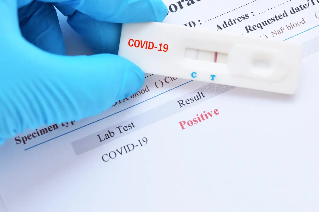 Positive test result by using rapid test device for COVID-19, novel coronavirus 2019 found in Wuhan, China