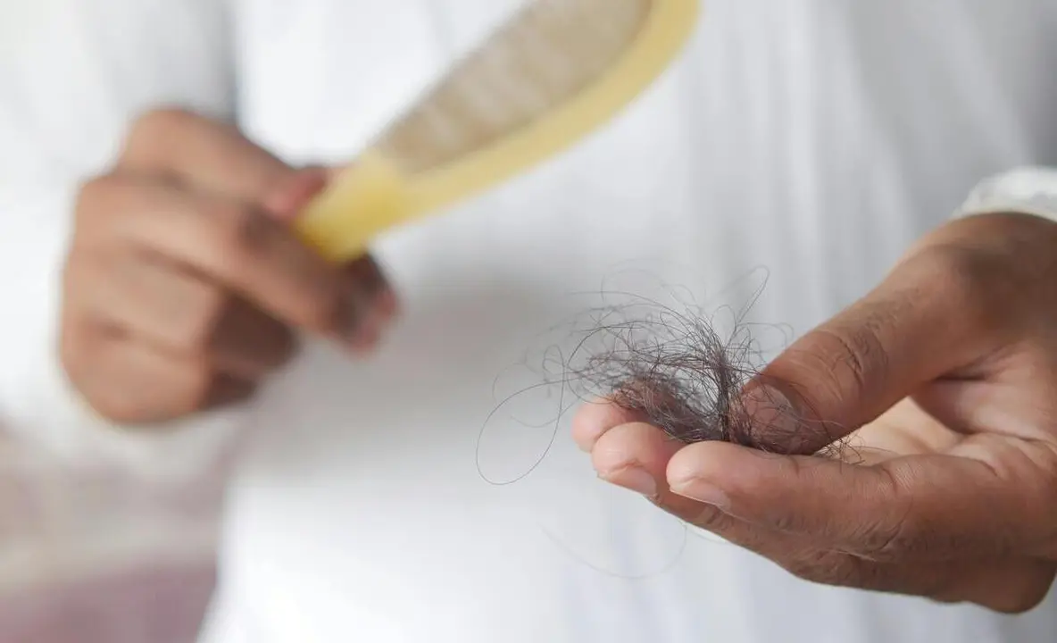 Caída del cabello | Fuente: Pexels
