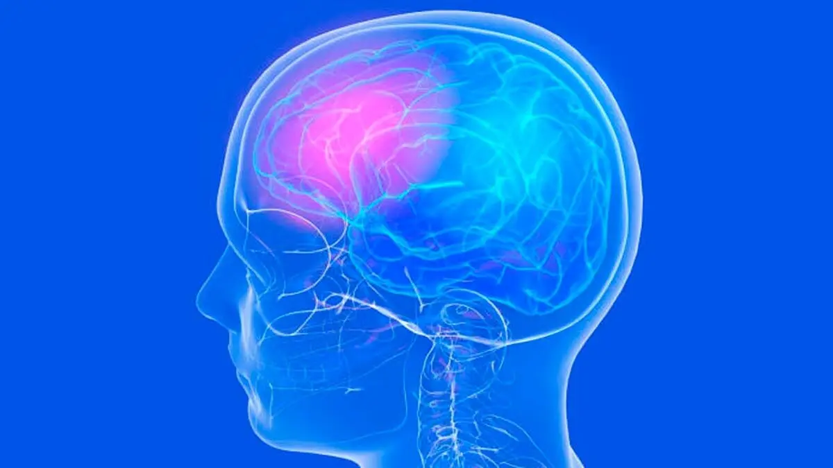 Ictus@foto istockphoto