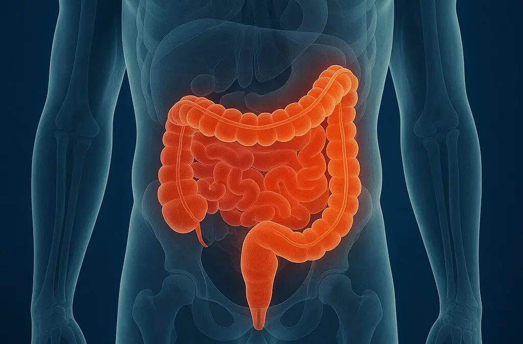 Cáncer de colon