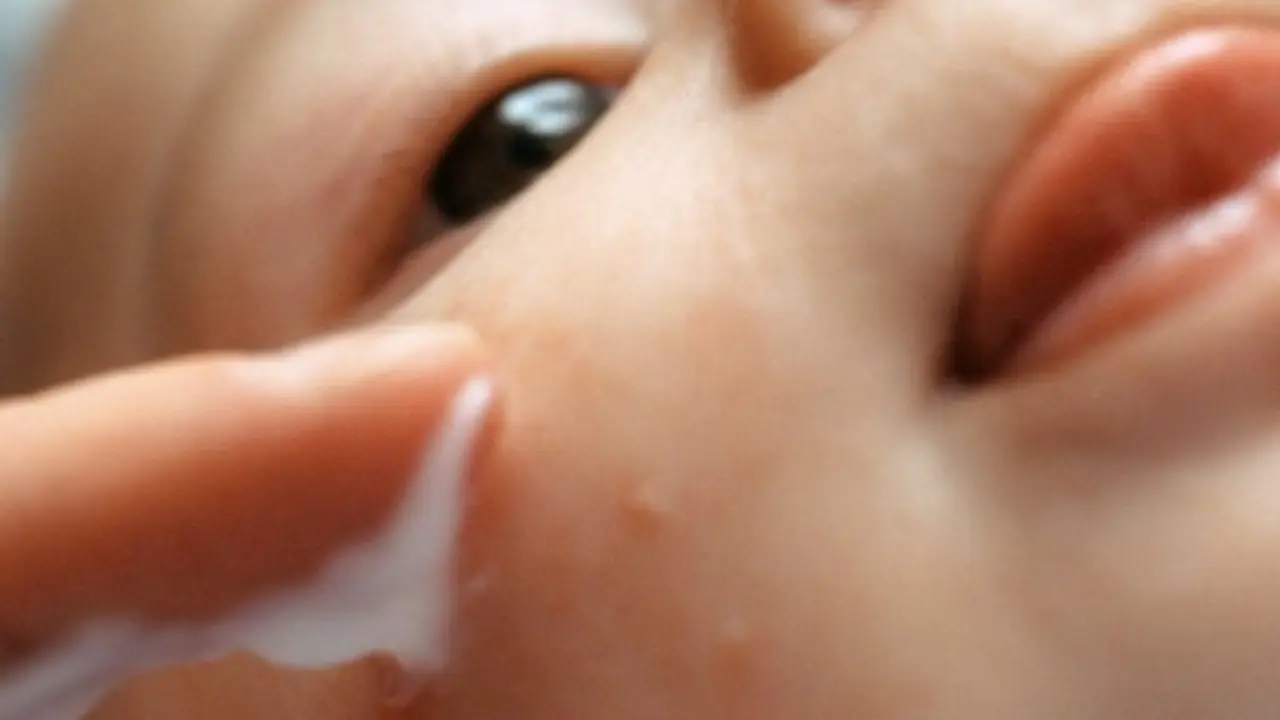 Baby having lotion applied to pipmles on face, extreme close-up 
bebe niÒo de pecho puericultura salud crema grano dedo aplicar bebes bebes dedos cremas padres niÒo dos personas caucasico niÒez filiacion enfermedad amor bienestar irritacion hidratacion cuidado vida alergia nueva vida interior dia mano cabeza boca lengua nariz esparcir irritado cara ojo sacar la lengua hidratar amable vista parcial primer plano plano macro foco suave color derramar desparramar salpicar vista acotada cropeo colores infancia niÒos infantes nene manos cabezas bocas lenguas narices parentesco esparcimos esparcieron enfermedades caras ojos detalles vistas parciales diseminar repartir vistas acotadas cropeos esparsimos vistas parsiales