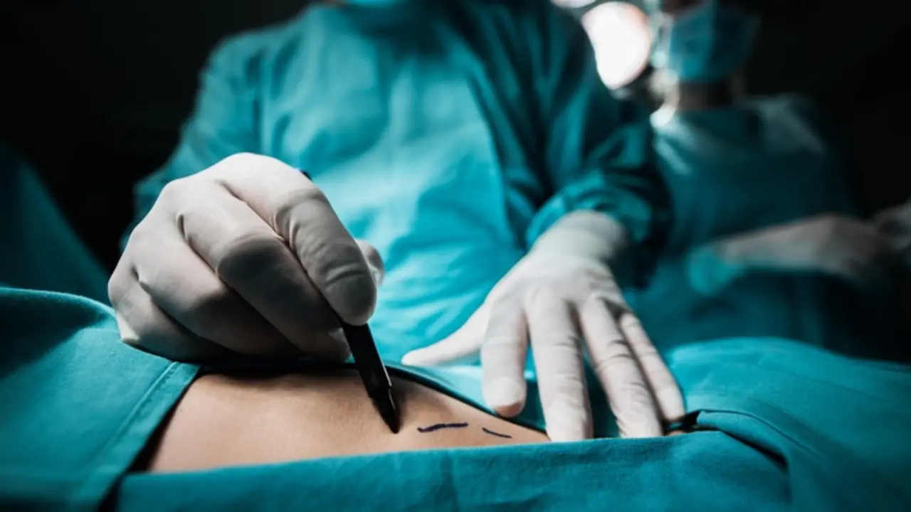 Close up of a plastic surgeon marking the human skin for surgery.