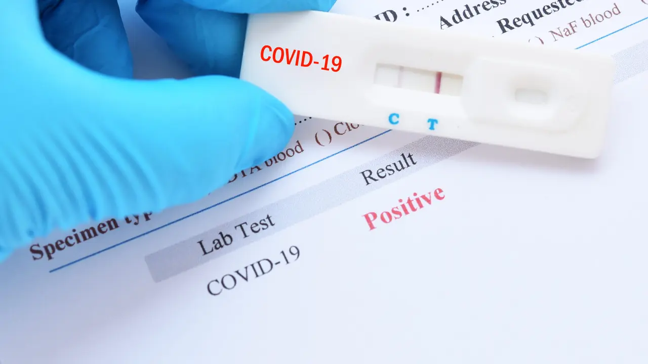 Positive test result by using rapid test device for COVID-19, novel coronavirus 2019 found in Wuhan, China