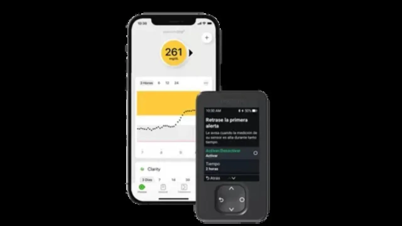 Dexcom