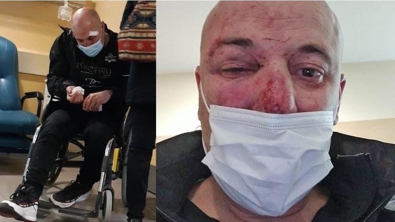 Foto del hombre agredido por los policías