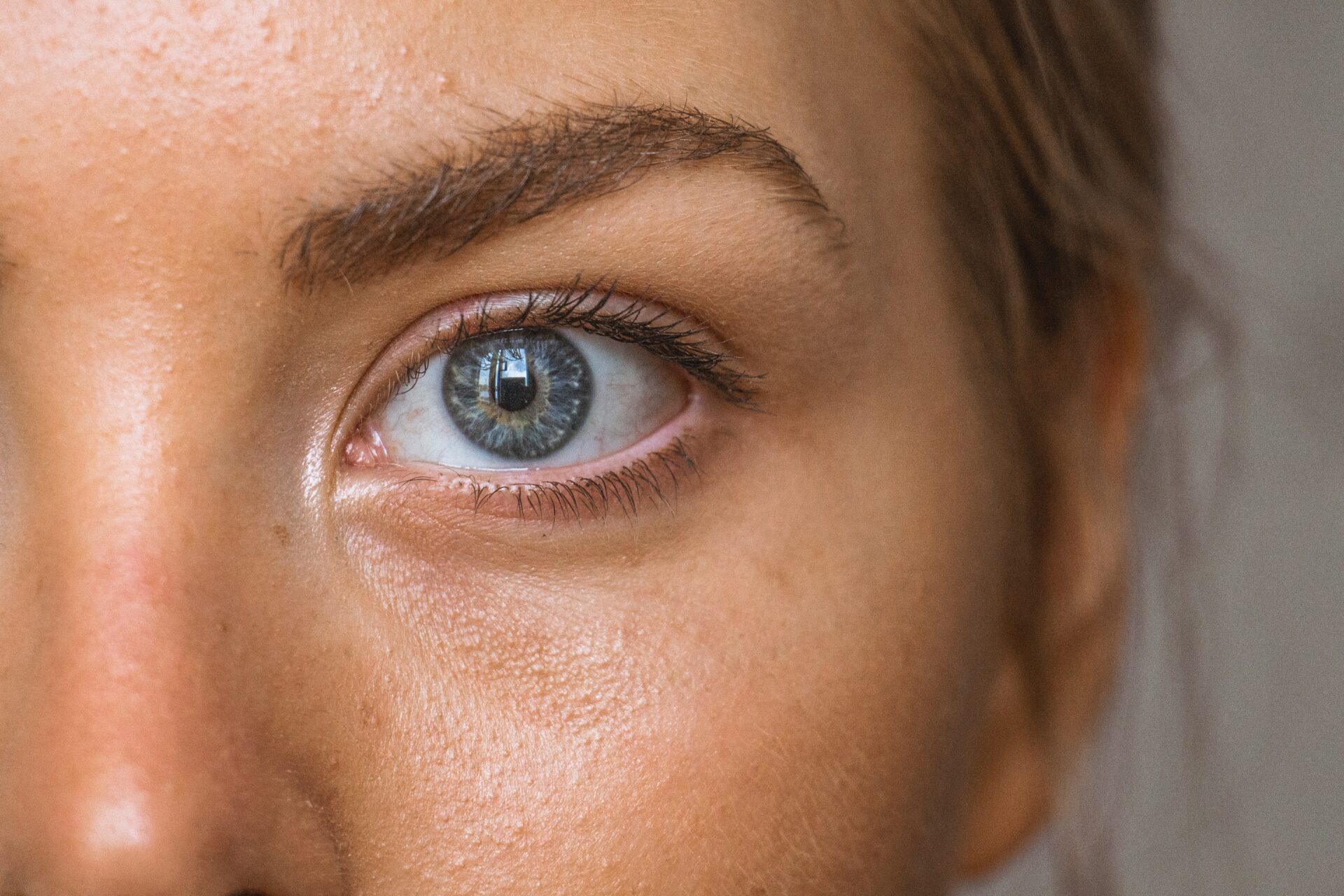 ojeras