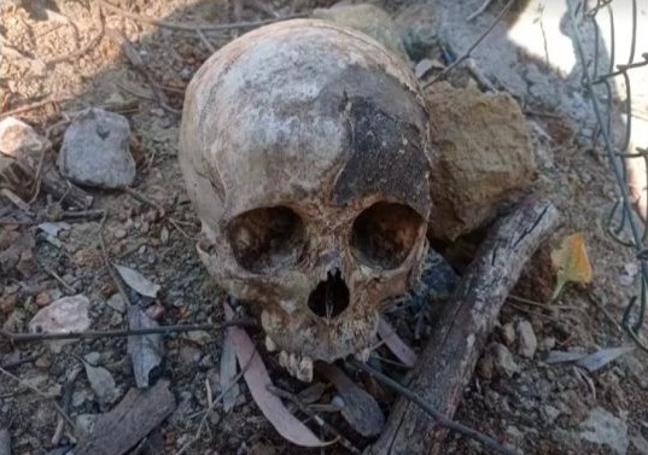 Calavera encontrada por el jardinero junto a otros restos
