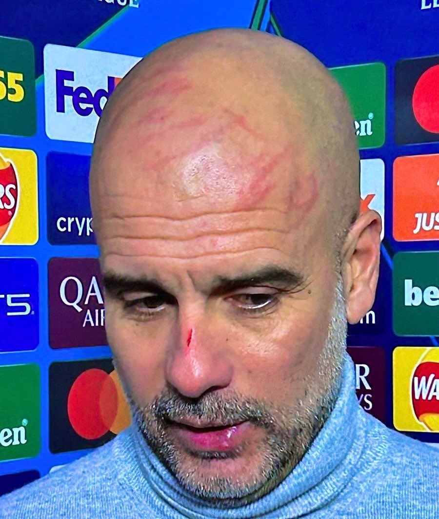 PSG y Manchester City en apuros