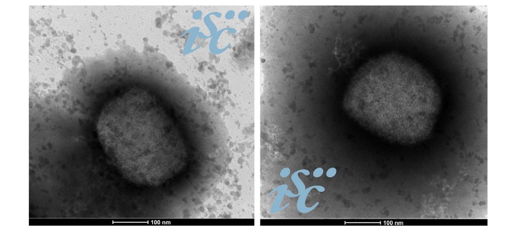 Dos Imágenes Obtenidas Por Microscopía Electrónica Del Virus De La Viruela Del Mono. Imagen Unidad De Microscopía Electrónica Del Isciii.
