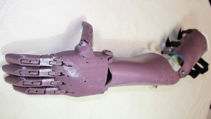 Más de 40.000 amputados usan prótesis obsoletas, según expertos