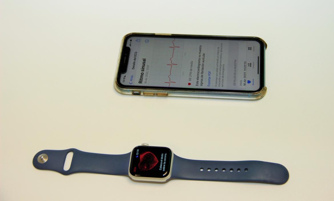 Imagen De El Hospital Clínico San Carlos Detecta, Con Un Smartwatch, Una Arritmia Grave En Un Paciente 1 Smartwatch